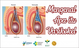 Mengenal Apa Itu Varikokel