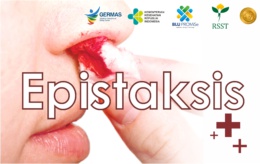 Epistaksis