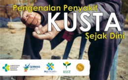 Pengenalan Penyakit Kusta Secara Dini