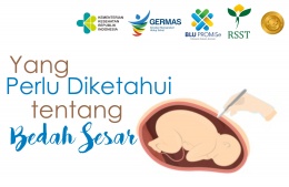 Yang Perlu Diketahui tentang Bedah Sesar