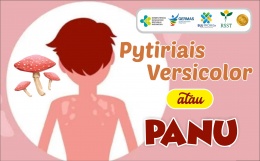 Pytiriais Versicolor (Panu)
