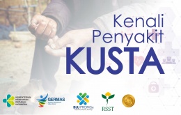 Kenali Penyakit Kusta