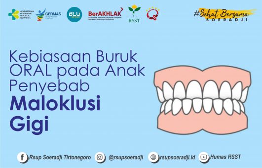 Kebiasaan Buruk Oral pada Anak Penyebab Maloklusi Gigi