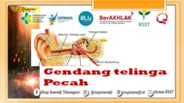 Gendang Telinga Pecah