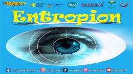 Entropion