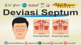 Deviasi Septum