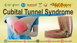 Cubital Tunnel Syndrome