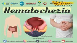 Hematochezia