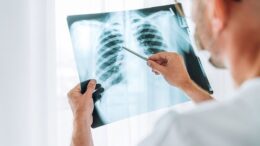Melacak Jejak Kanker Paru: Peran Penting Bronkoskopi dalam Diagnosis Dini