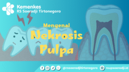 Mengenal Nekrosis Pulpa