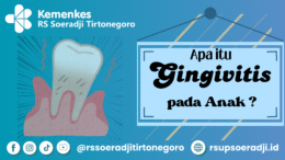 Apa itu Gingivitis pada Anak ?